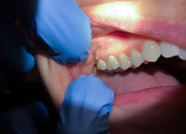 Best Cracked Tooth Emergency Dentist  in Monahans, TX